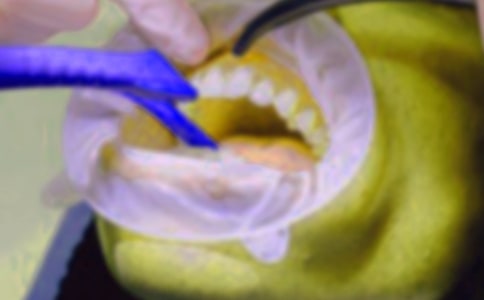 ������(y��u)�����ģ��\��15ƪ��