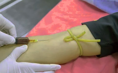 ���򲡻��߸��x�ž��x��ƪ����